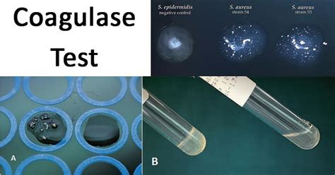 1.24: Coagulase Test .